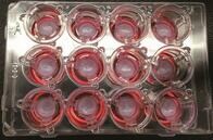 3Dプリンターで「移植可能な臓器」ができる日は近い：最新研究
