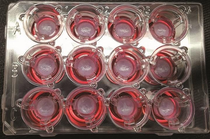 患者の細胞を使えば拒絶反応のリスクも低下する（3D印刷された組織片）　PAIGE DERR AND KRISTY DERRーNICATS