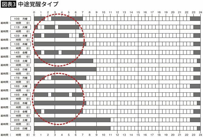 図表３中途覚醒タイプ