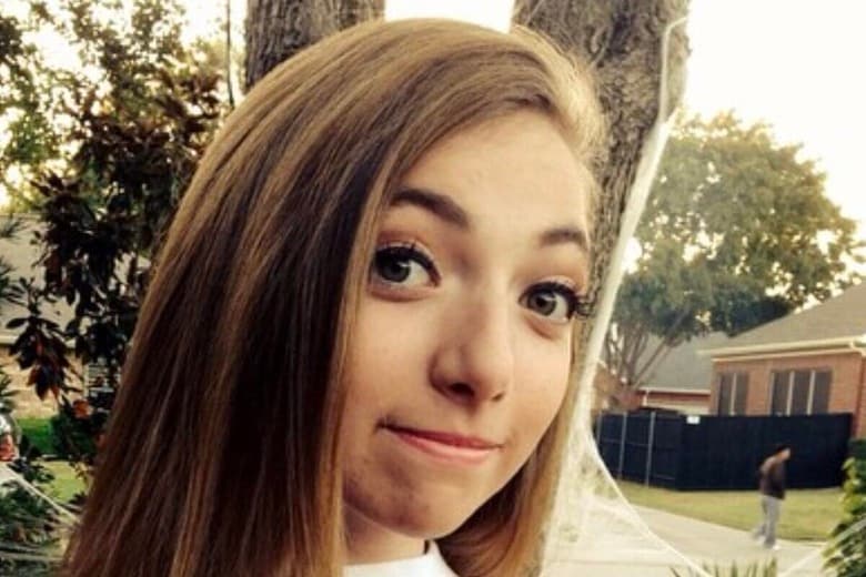 犬による重傷事件から4年、被害女性が動画で現在を発信　jacqueline_claire99-Instagram