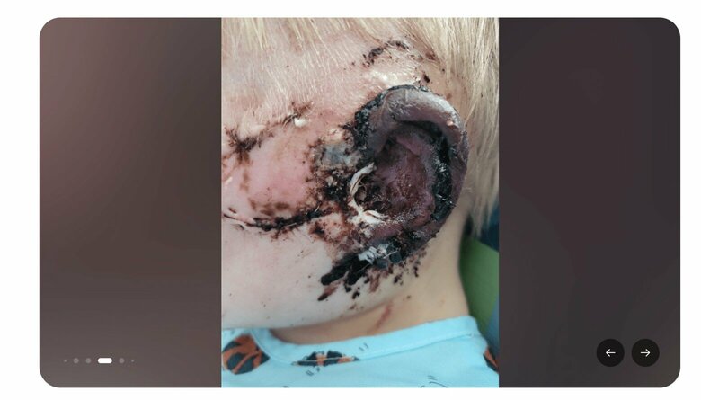 警官が目撃した「乳児を襲うピットブル」...死亡した祖父と生後3カ月の孫の姿　Tracy Moore-GoFundMe