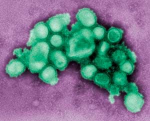 迫りくるパンデミック