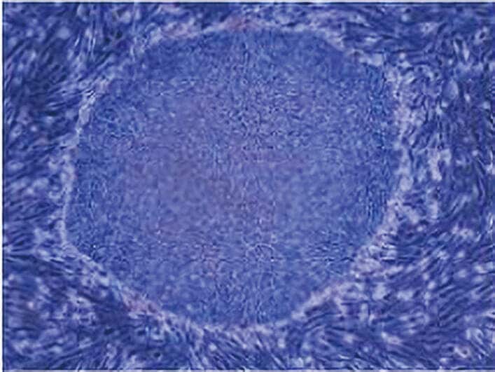iPS細胞の上清液には、創傷治癒・皮膚のターンオーバー／細胞保護・神経修復／線維化修復機能／心筋保護作用、などが期待されている。