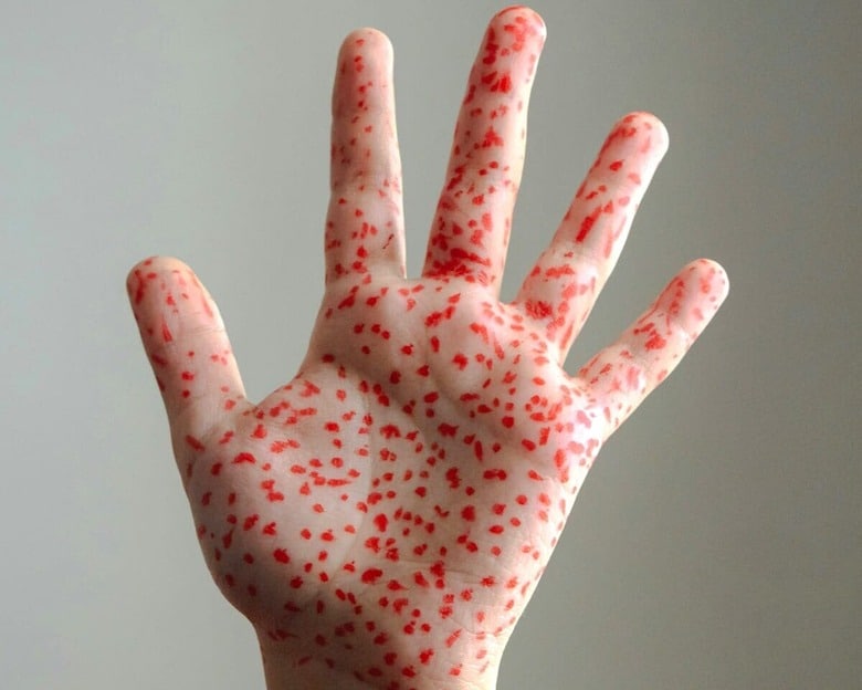 （写真はイメージです） lonely blue-Unsplash