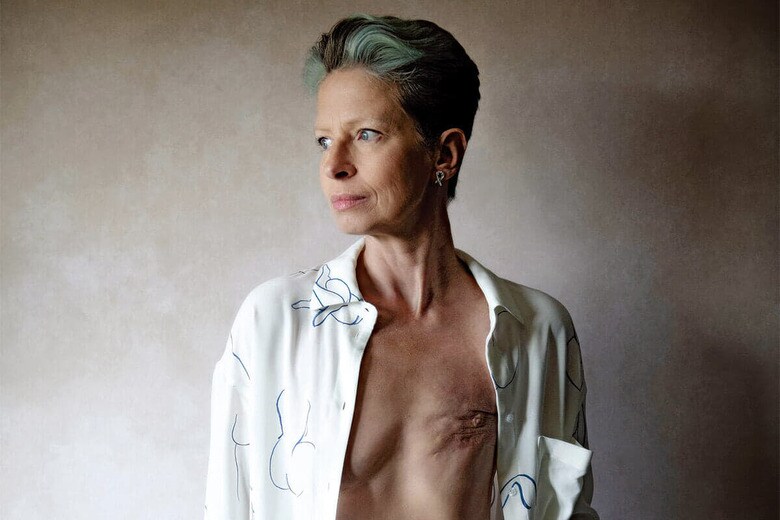 乳房切除の傷痕を見せるオリオーダン　DR. LIZ O\'RIORDAN/JENNY SMITH