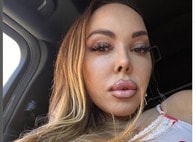 【写真】「豊尻」施術の失敗で、米女優が死亡...「お尻レディ」の異名で知られた無資格の施術者に有罪判決