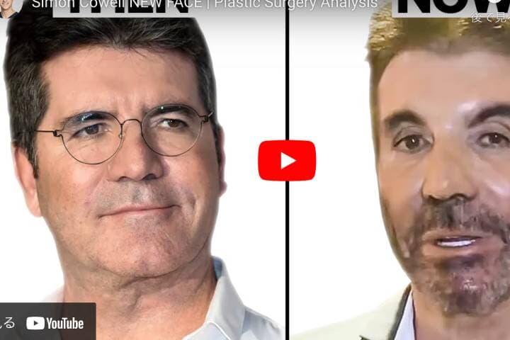 オーディション番組の辛口審査員で知られるサイモン・コーウェル（63） YouTube/@drgarylinkov