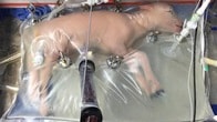 プラスチック製「人工子宮」でヒツジの赤ちゃんが正常に発育