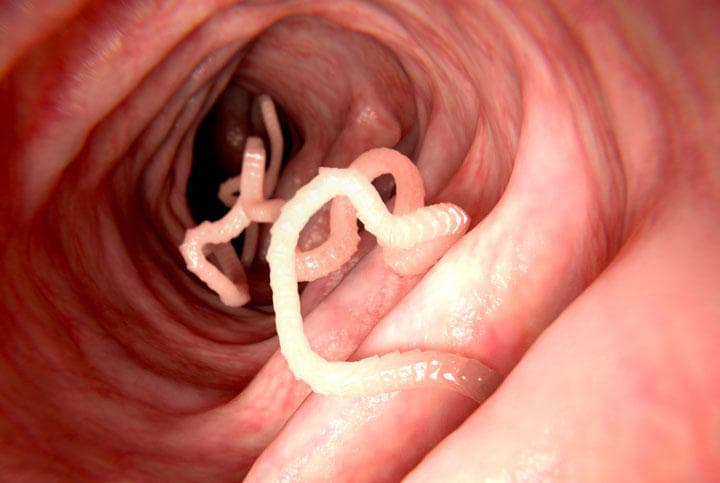 サナダムシは通常は腸にいるが、繁殖期になると体内を遠くまで移動することも　photographer/iStock.