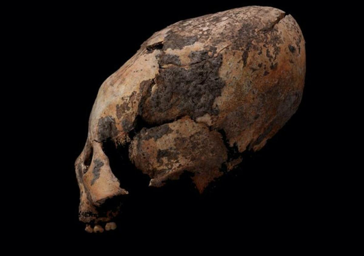 人為的に変形された1万2000年前の頭蓋骨が中国で発掘される | ニューズ