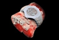 世界初の「カラーX線写真」──体内の構造を3D画像で再現