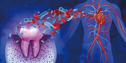 歯周病はなぜ危険なのか──心臓、脳、腎臓まで蝕む「慢性炎症」の連鎖