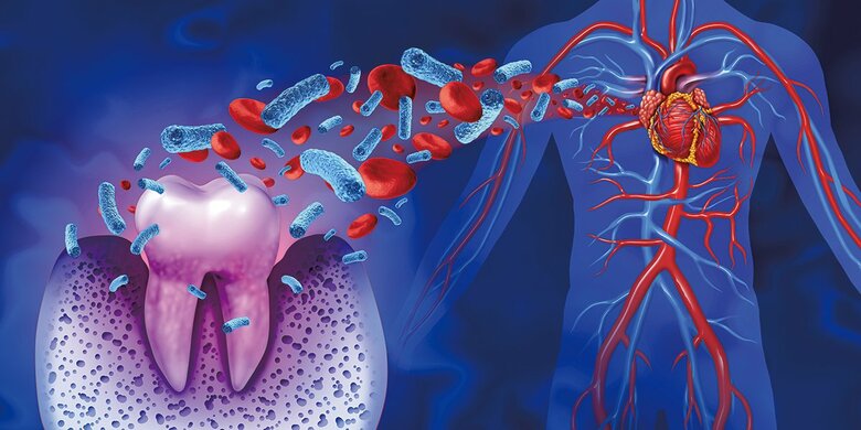 歯周病は全身の血管を「炎症状態」に置き続ける火種となる　ILLUSTRATION BY LIGHTSPRING/SHUTTERSTOCK