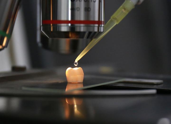 世界初！歯のエナメル質を修復　Zhejiang University