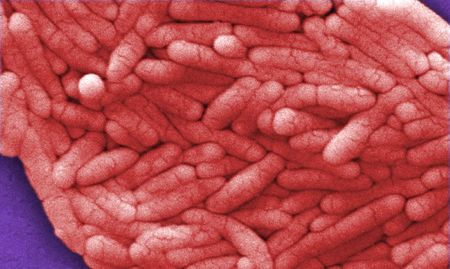 　５月２３日、米疾病対策センター（ＣＤＣ）は、公衆衛生当局が家禽（かきん）との接触に関連したサルモネラ菌感染が複数の州で流行しているとして調査に入っていると明らかにした。写真はサルモネラ菌。米カリフォルニア州 ロサンゼルスで２００９年８月撮影（２０２４　ロイター／Janice Haney Carr）