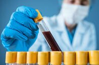 「O型の人は新型コロナにかかりづらく、重症化しづらい」との研究結果