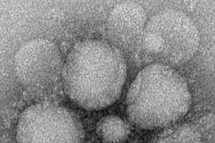 新型コロナウイルス 米CDCが顕微鏡写真公開　Cynthia Goldsmith/Maureen Metcalfe/Azaibi Tamin/Centers for Disease Control and Prevention/Handout via Reuters