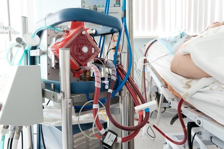 新型コロナ患者にとって「最後のとりで」とされる人工肺 ECMO　Akiromaru-iStock