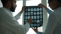 若年性認知症のリスクを高める「ある疾患」　最大6倍との研究結果