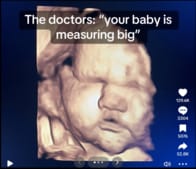 デカすぎ...母親の骨盤を砕いて生まれてきた「超巨大ベビー」の姿にSNS震撼「ほぼ幼児では？」