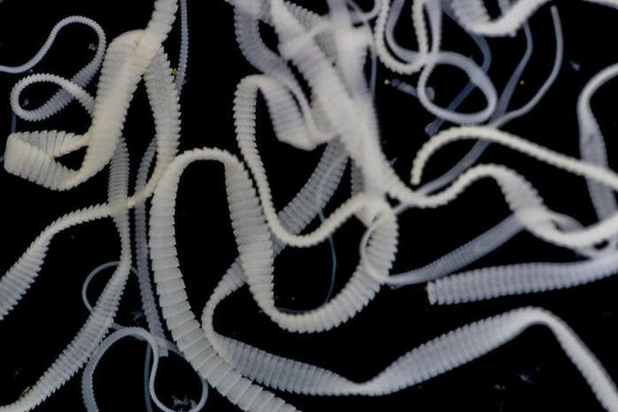突然の激しい発作に意味不明の言葉──原因は20年前に脳に侵入した