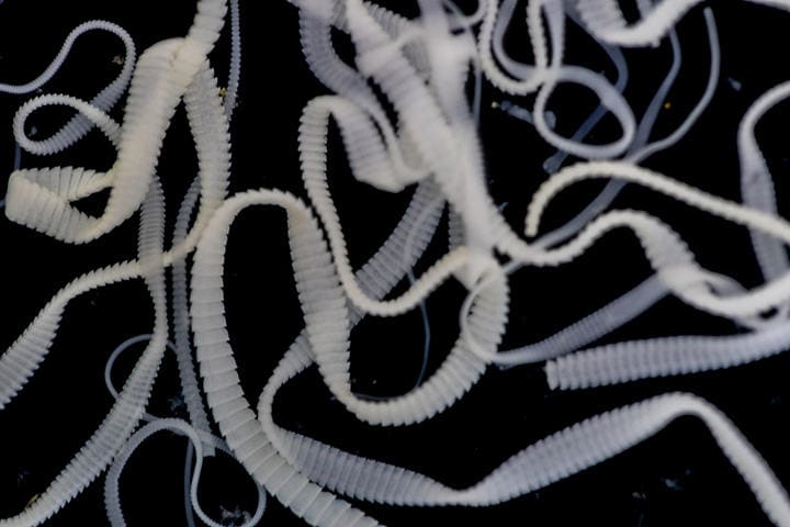 目に見えないほど小さなサナダムシの卵は生鮮食品や糞便に紛れているので要注意　Sinhyu-iStock