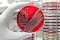 多剤耐性菌「MRSA」をロケットで打ち上げへ：宇宙で突然変異を実験