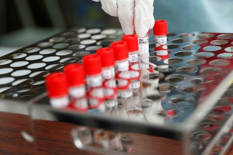 人口1000人当たりの日本の検査数は、経済協力開発機構(OECD)加盟国37国のなかでメキシコに次いで2番目に少ない。写真はPCR検査のシミュレーションをする医療関係者。4月22日、東京都江戸川区で撮影(2020年　ロイター/Issei Kato)