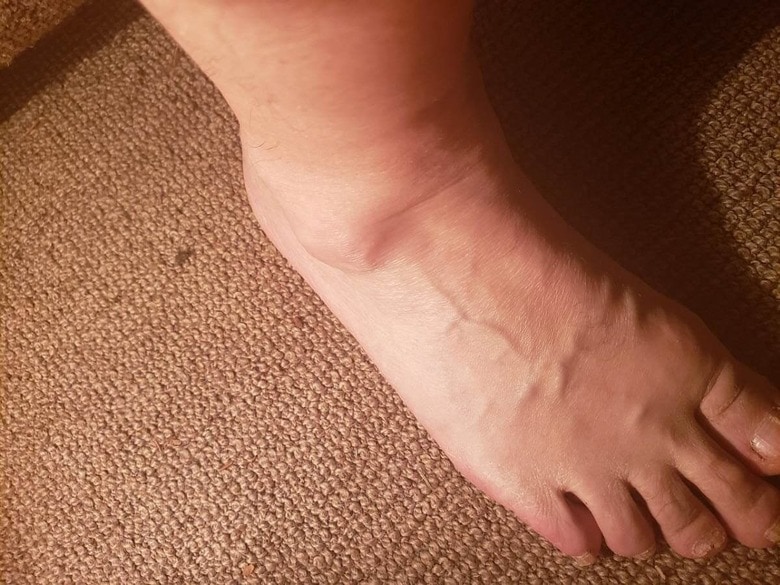 写真はイメージです　PAEdavid/Pixabay