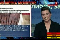 サル痘の流行は「ウクライナ支援国」のゲイばかりと、ロシア国営TVで嘲笑