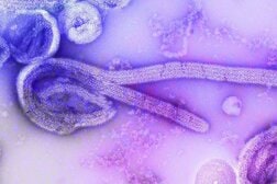 致死率50％に迫る…ケニアでもエボラ出血熱の症例、国境を越えた感染拡大の不安が現実に