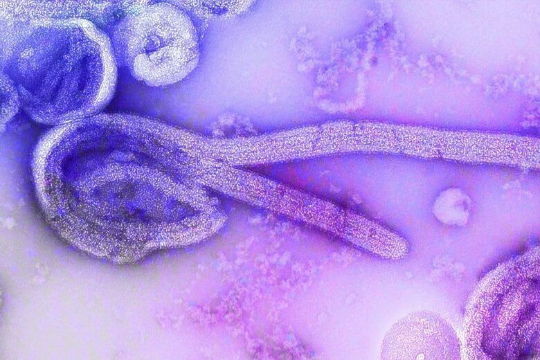 感染の拡大が続くエボラ出血熱（写真はイメージです）　CDC-Unsplash