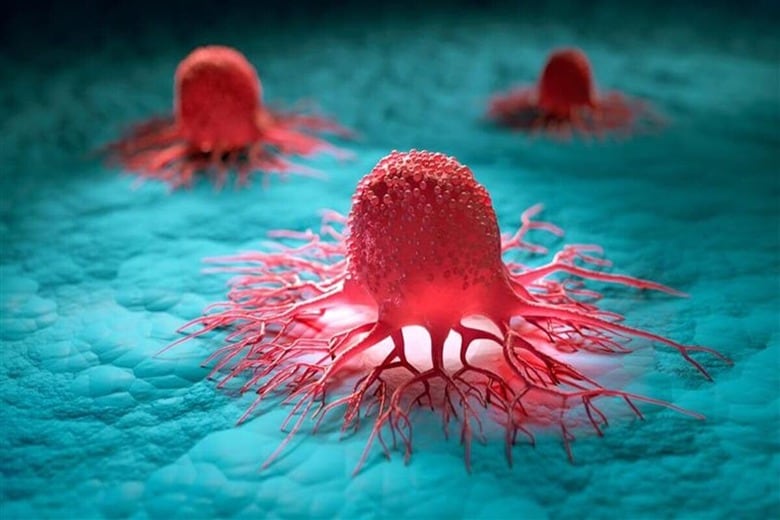 がん細胞のイメージ　peterschreiber.media-shutterstock