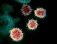 新型コロナウイルス、発症1─3日前から他人に感染させる可能性＝米CDC調査