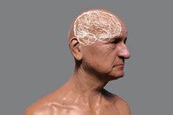 「アルツハイマー病は脳疾患ではないかもしれない」との仮説