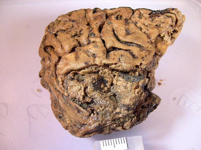 なぜヒトの脳組織がこれほど長期にわたって保存されていたのか ...... Dr Axel Petzold