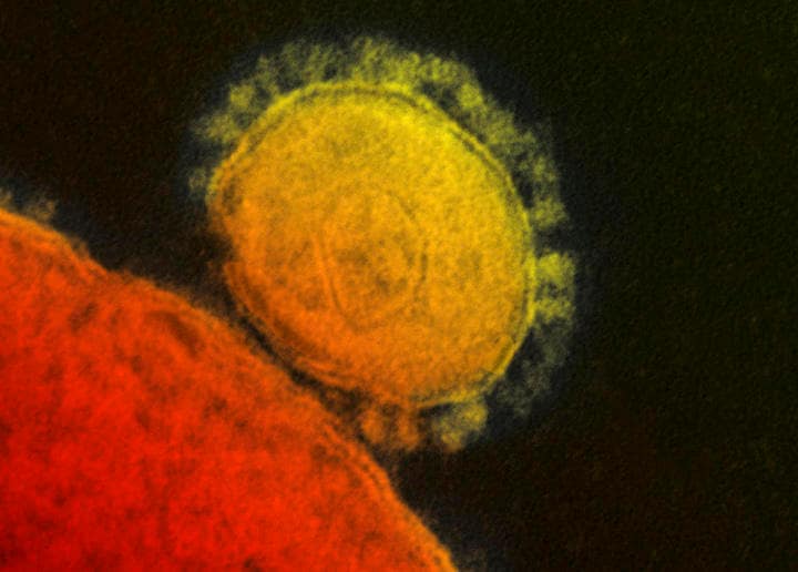 「MERS」のときのコロナウイルス　REUTERS/National Institute for Allergy and Infectious Diseases