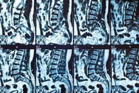 その腰痛は大丈夫？　手術で治療すべき腰痛とは