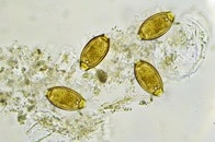 欧州初、ドイツで寄生虫の卵のサプリメントが合法的に販売開始か？