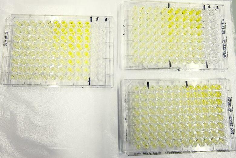 米トランプ政権が新型コロナウイルスのワクチン開発を加速させる計画を水面下で策定していると、ブルームバーグが29日に関係筋の情報として報じた。スイスのベルン大学の研究所で22日撮影（2020年　ロイター/ARND WIEGMANN）