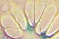 リバースエイジング！　英大学が、ヒトの老化細胞を若返らせることに成功