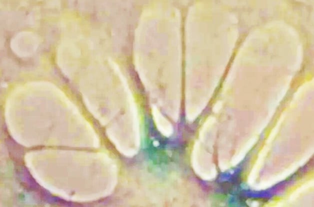 ヒトの老化細胞を若返らせることに成功　image credit:Lorna Harries / Matt Whiteman