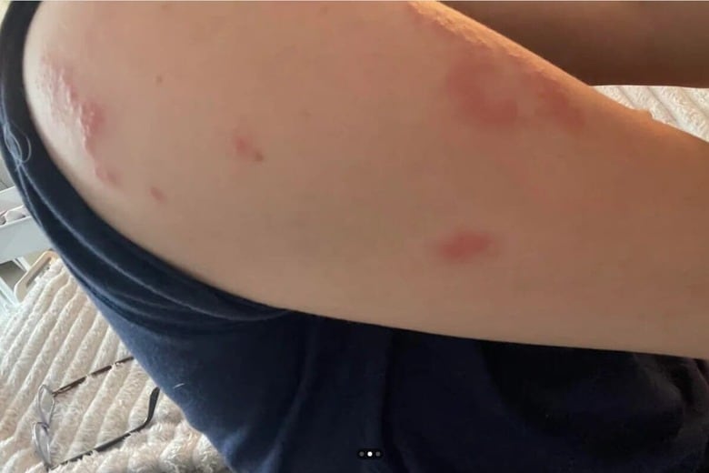 Reddit/u/survivorsavedmylife