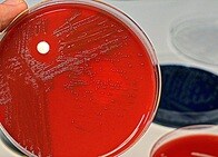 どの抗生物質も効かない......「スーパーバグ」が世界に蔓延、豪科学者が警告
