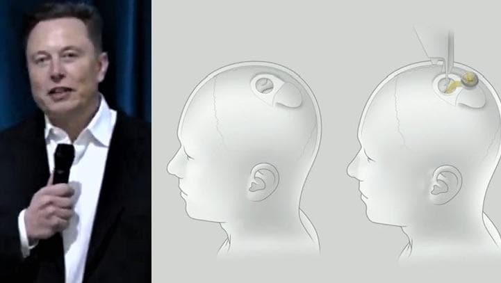 イーロン・マスクは、ニューロテクノロジー企業「ニューラリンク」の成果を発表した...... neuralink