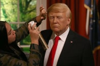 「無理なハゲ治療」　ついに明かされたトランプヘアの真実