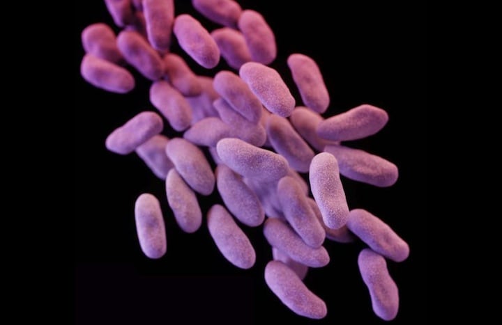 「悪夢の細菌」とも呼ばれるカルバペネム耐性腸内細菌　CDC-REUTERS
