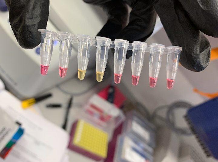 迅速に結果が判定できるLAMP法　photo/genengnews