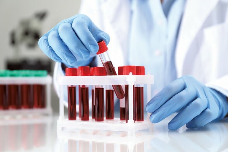 血液検査で大腸がんの再発や転移のリスクが予測可能に？　手がかりは「アミノ酸のネットワーク」