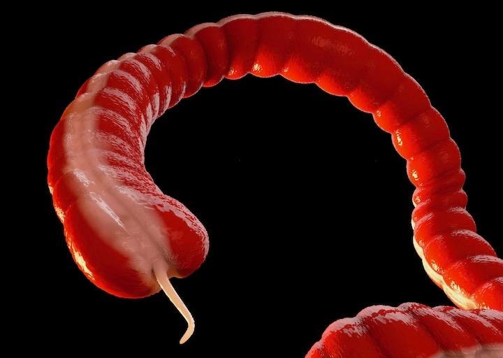 虫垂のCG画像　tussik13-iStock